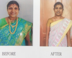 nalam acupuncture